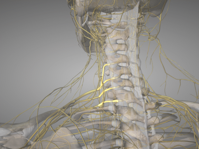 Solving Neck Pain and Arm Weakness: When is it Cervical Radiculopathy, and Why Does Diagnosis Matter?